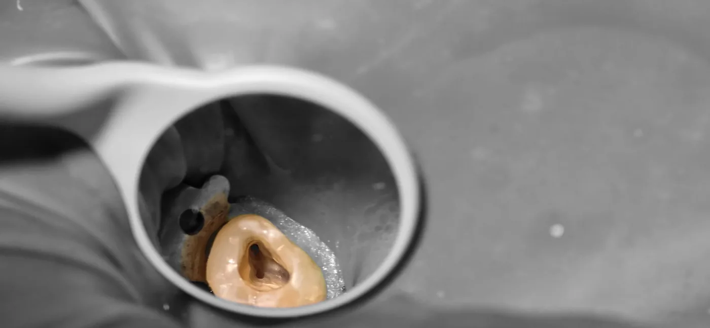 Endodoncie