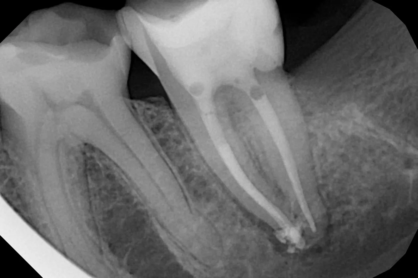 Endodoncie
